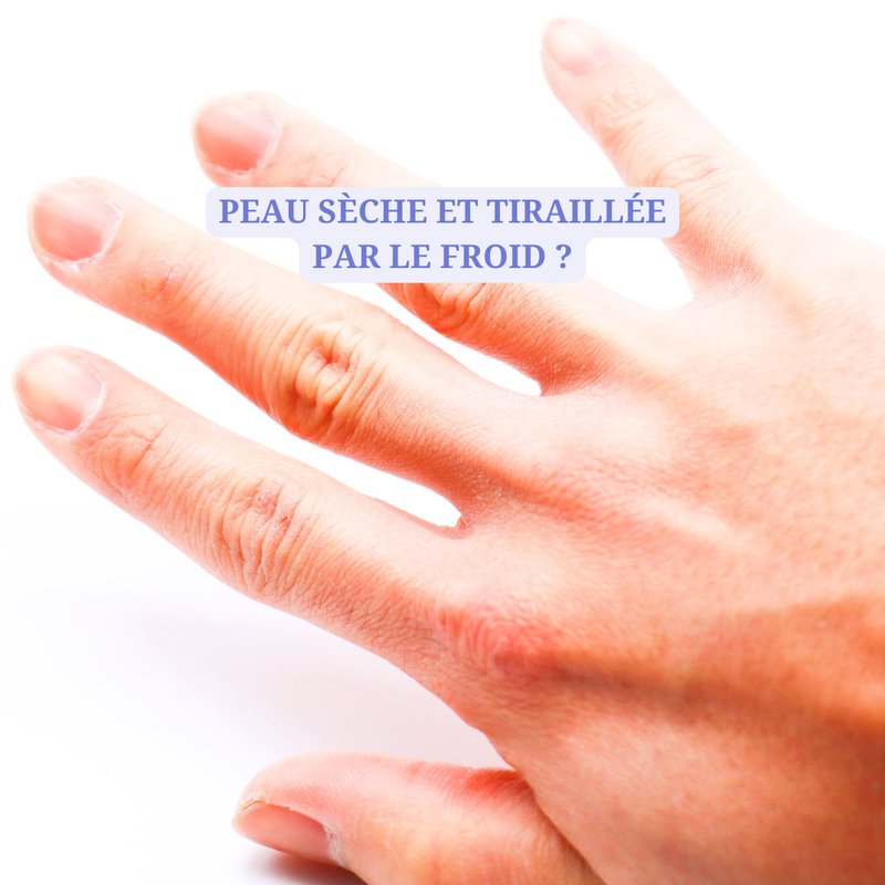 Comment protéger efficacement sa peau sèche en hiver ?