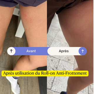 Duo Zéro Frottement