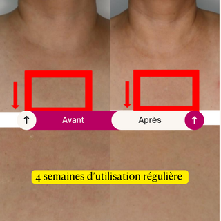 Masque Lissage Effet Peau Neuve